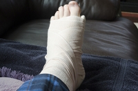 Recovery Process for a Broken Foot