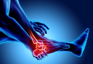 Risk Factors for Foot Stress Fractures