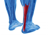 Possible Treatments for an Achilles Tendon Injury