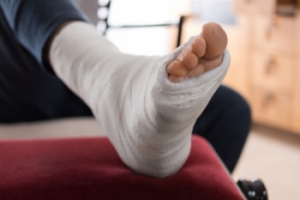 Broken Foot Treatment Options