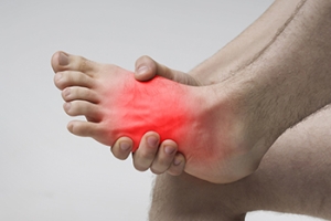 Explaining a Mid-Foot Stress Fracture